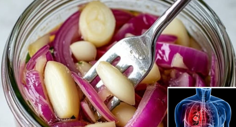 recipe-for-red-onion,-garlic,-and-honey-to-tre:at-lungs,-cough,-and-colds