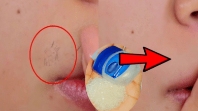 can-vaseline-be-used-for-upper-lip-hair-removal-or-facial-hair-removal?