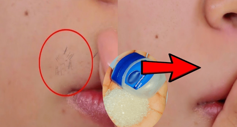 can-vaseline-be-used-for-upper-lip-hair-removal-or-facial-hair-removal?