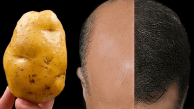 revive-your-hair-naturally:-the-magic-of-potatoes