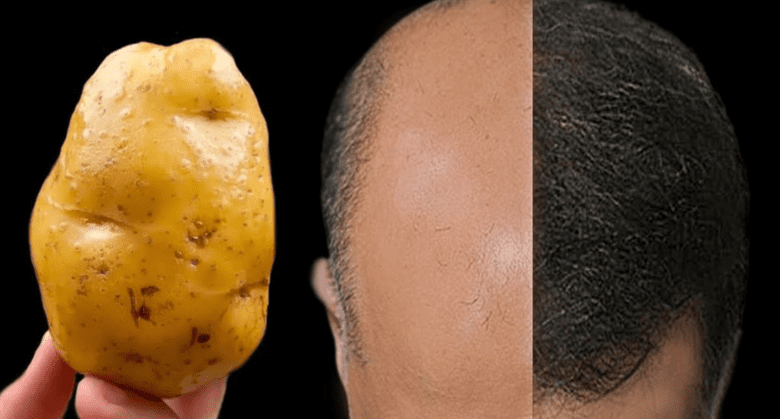 revive-your-hair-naturally:-the-magic-of-potatoes