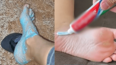 get-rid-of-cracked-heels-with-toothpaste:-a-simple-and-effective-remedy