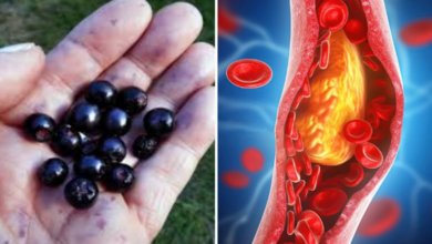 aronia:-super-berry-for-stronger-blood-vessels-and-lower-cholesterol