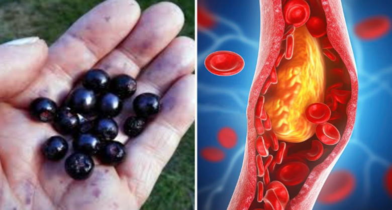 aronia:-super-berry-for-stronger-blood-vessels-and-lower-cholesterol