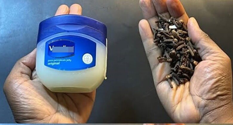 mix-vaseline-and-cloves:-a-homemade-secret-to-meet-multiple-needs