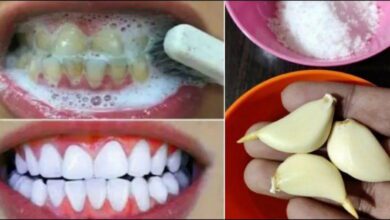 teeth-whitening-at-home:-how-to-naturally-whiten-yellow-teeth-with-garlic-and-baking-soda