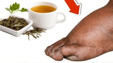 drink-parsley-tea-and-say-goodbye-to-swollen-legs,-ankles,-and-feet!