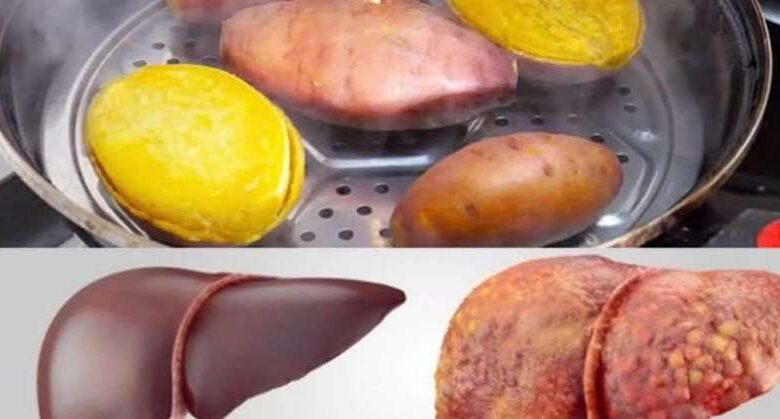 eating-steamed-sweet-potatoes-every-day,-woman-panicked-when-receiving-liver-test-results:-how-could-this-be?