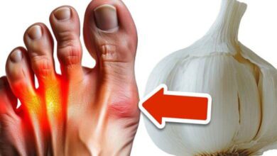 the-surprising-power-of-garlic-in-eliminating-gout