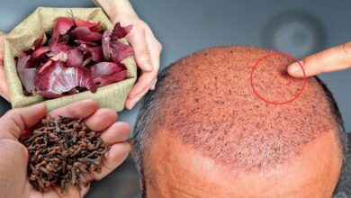 the-surprising-hair-growth-benefits-of-cloves-and-onion-peels