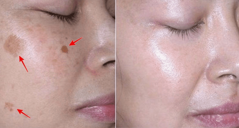 erase-age-spots-with-baking-soda-is-your-simple-solution-for-flawless-skin