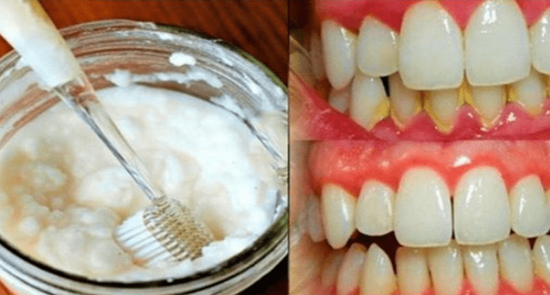 a-simple-way-to-get-rid-of-bad-breath-and-get-rid-of-mouth-bacteria