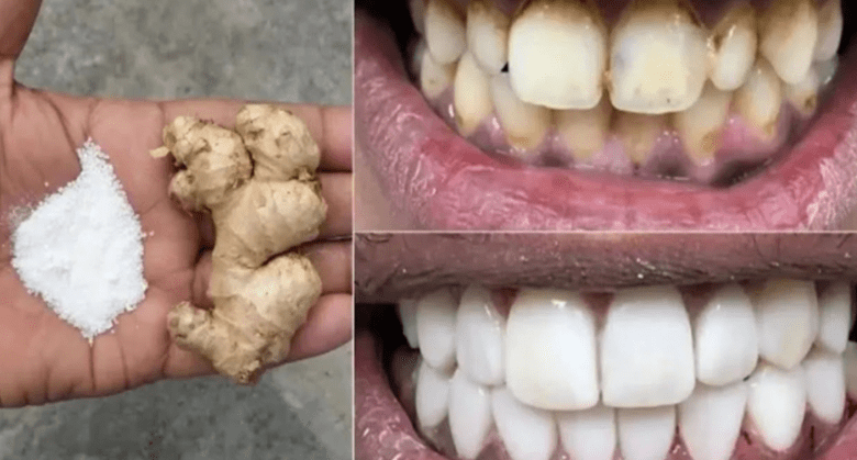 whiten-your-teeth-–-home-remedy-with-ginger-&-salt