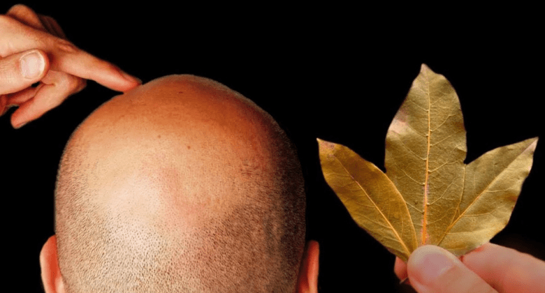 unbelievable!-bay-leaves-might-be-the-secret-to-fuller-hair!