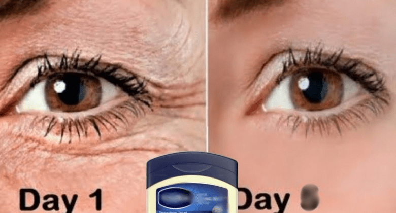 the-power-of-vaseline-to-remove-wrinkles!-look-younger-naturally