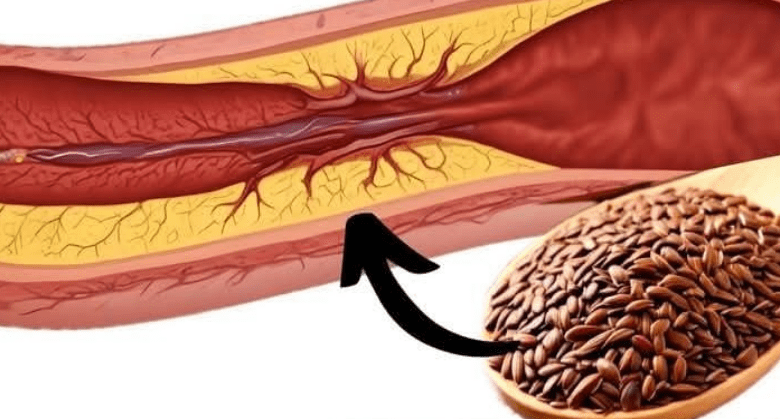 flaxseed:-a-natural-remedy-to-prevent-blood-clots,-heart-attacks,-and-strokes