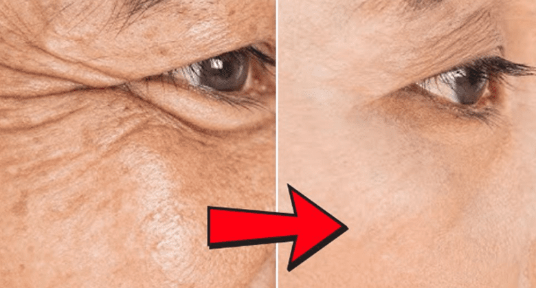 erase-wrinkles-and-freckles-with-a-simple-egg-and-coffee-remedy