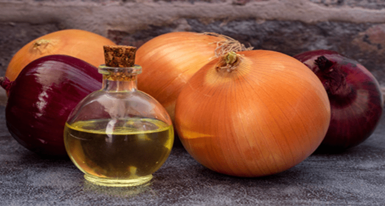 how-to-use-onion-juice-for-extreme-hair-fall,-hair-loss-&-dandruff