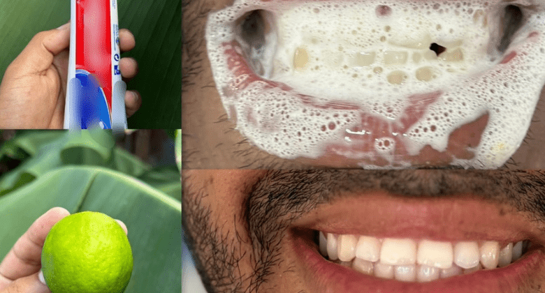 say-goodbye-to-yellow-teeth-with-this-natural-recipe!-get-whiter-teeth-without-spending-money-at-the-dentist