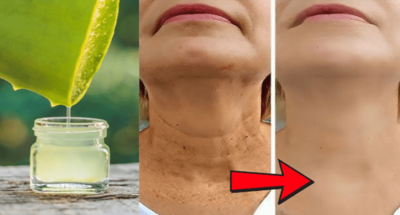 homemade-aloe-vera-face-moisturizer-for-oily-skin