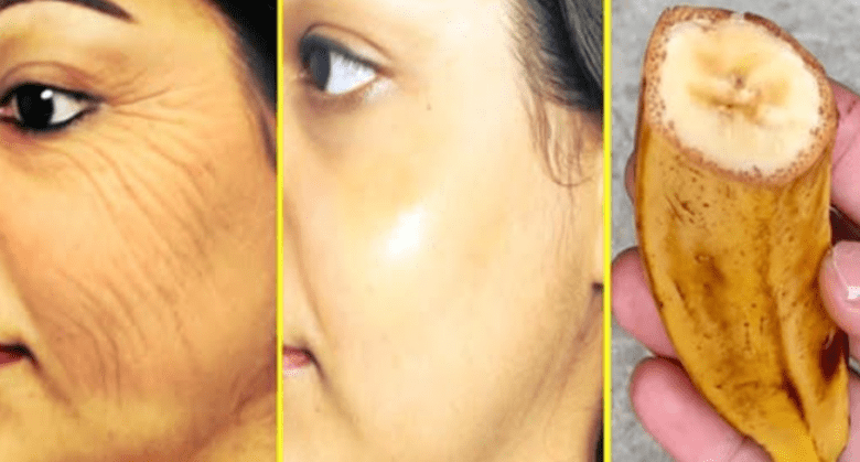 5-secret-formulas-to-diy-banana-mask-for-aging-skin-at-home