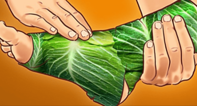 amazing!-get-rid-of-varicose-veins-–-just-put-these-leaves-over-and-wait!