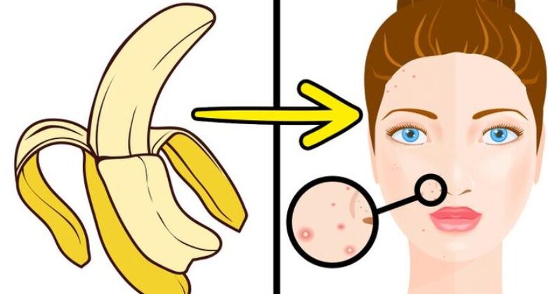 banana-peel-erases-wrinkles!-best-banana-peel-recipe-for-skin-care!