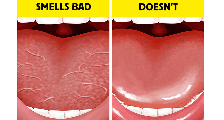 6-effective-ways-to-avoid-bad-breath-even-after-sleeping