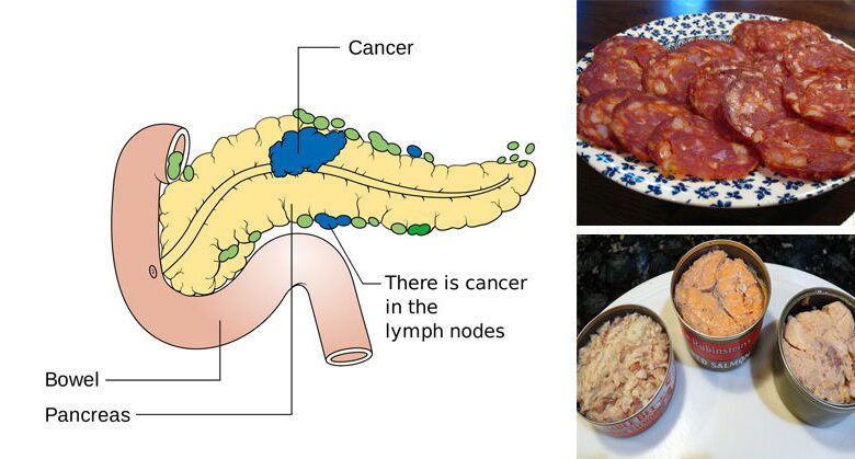 10-cance.r-linked-foods-you-should-never-put-in-your-mouth-again